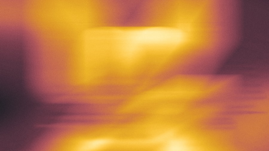 Photo cosmic microwave background rest frame dipole