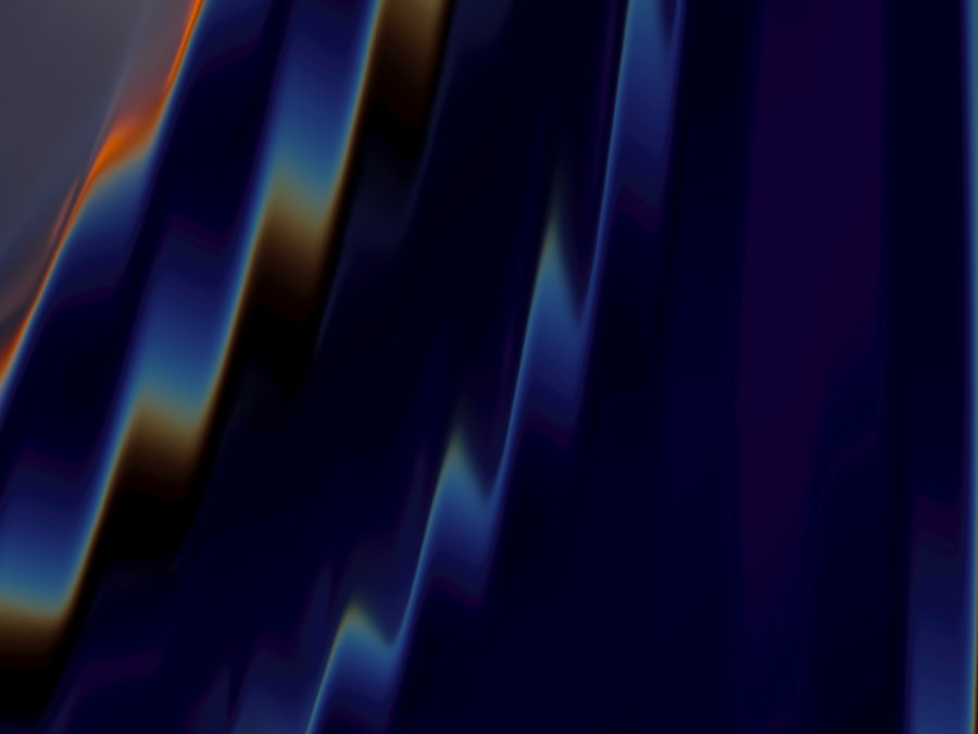 cosmic microwave background dipole alignment