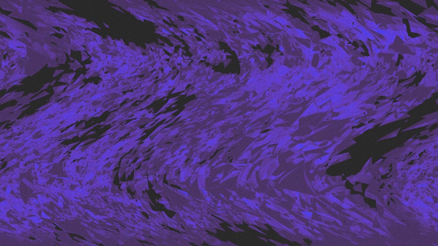 Photo cosmic microwave background dipole anomaly