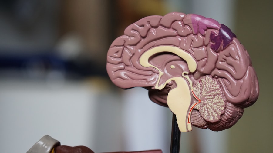 Photo brain experiences