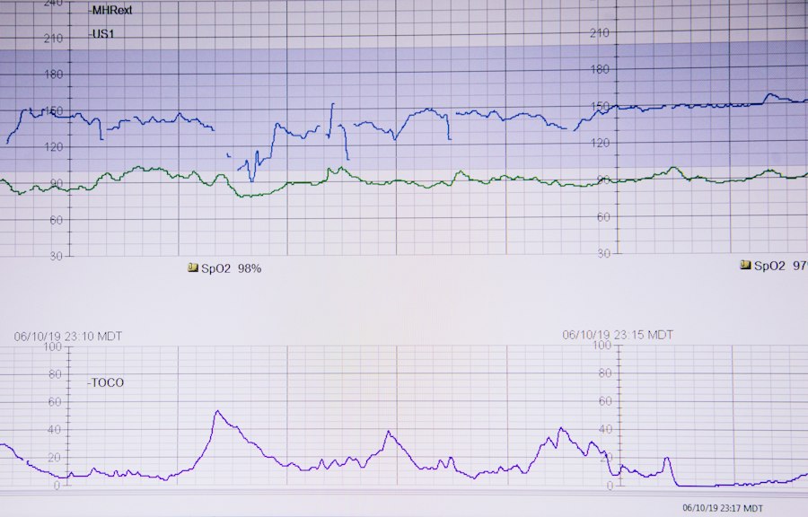broadband positive signal graph